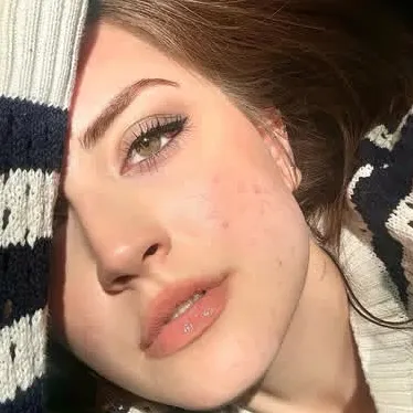 @esra.920