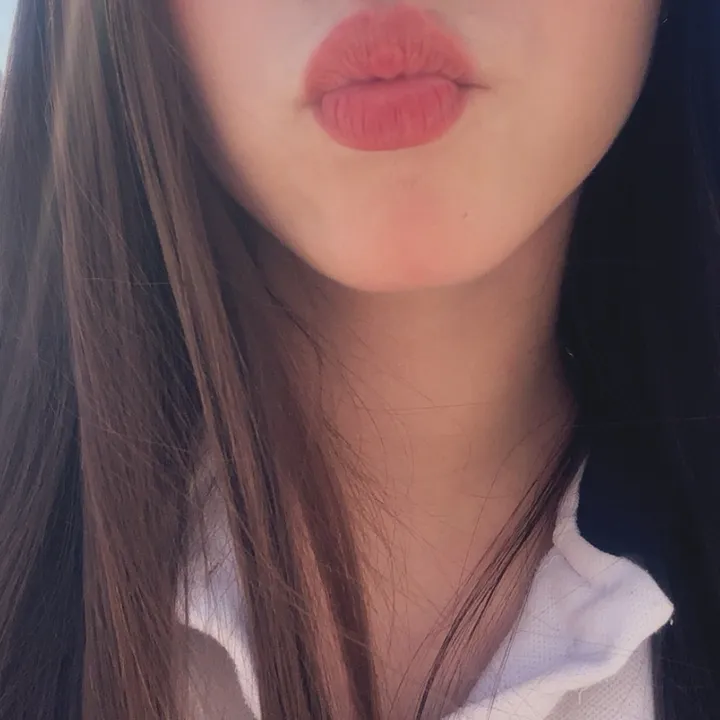 @____chr17