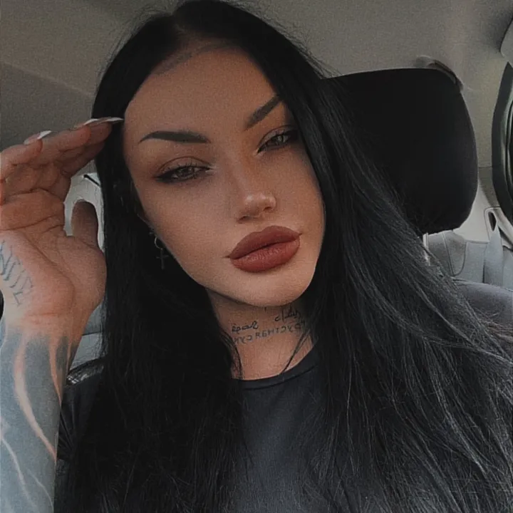 @exostoses