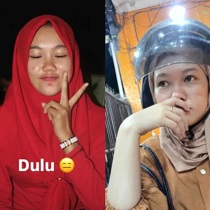 @cewebugis__