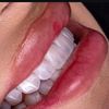 dentist_gunel