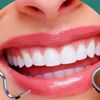 beautifull_teeth