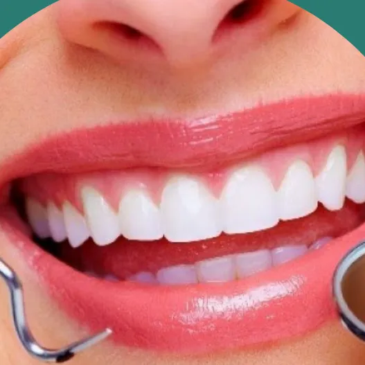 beautifull_teeth