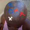 bald_head_girl