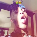 @chestxpain