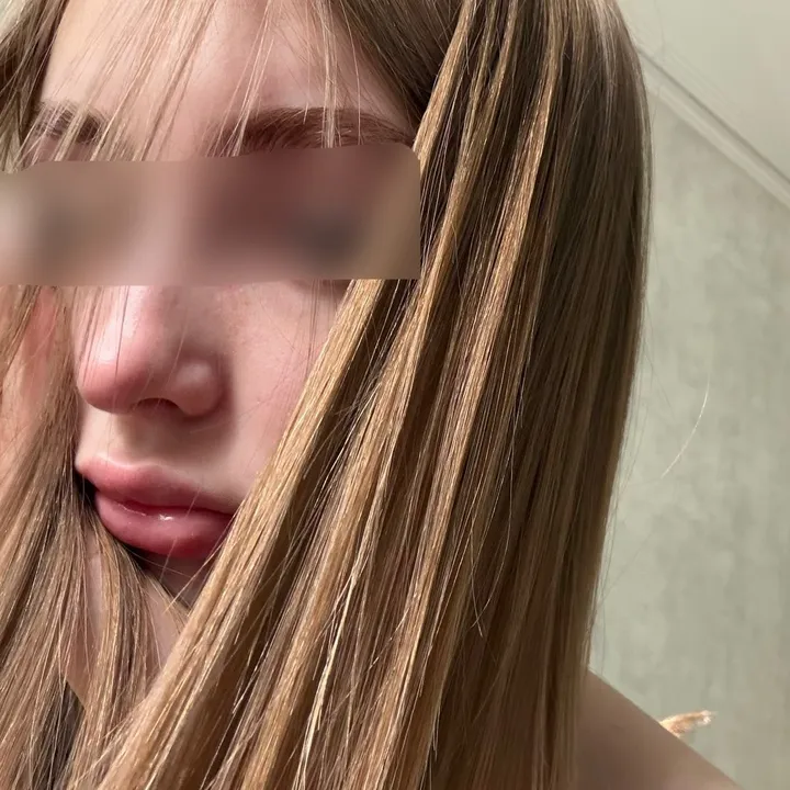 @kraselll