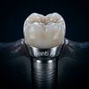 denti.ai