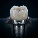 @denti.ai