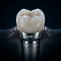 @denti.ai
