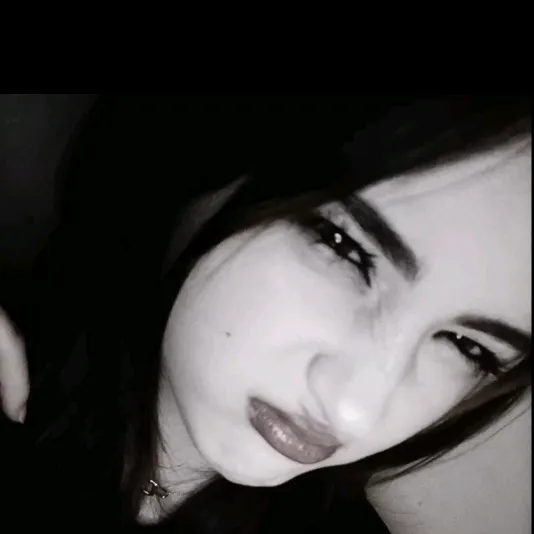 @skittise
