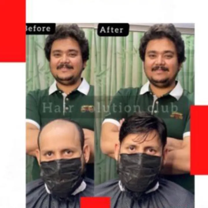 hairsolutionclub9