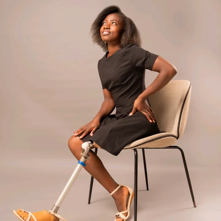 amputee_girl