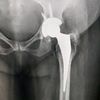 ortho_surgeon_arbind