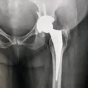 @ortho_surgeon_arbind