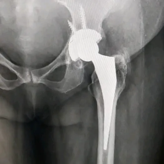 @ortho_surgeon_arbind