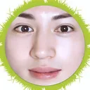 @komugiallergy