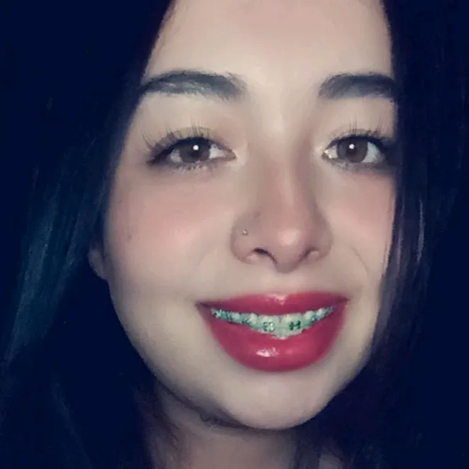 @lg.oa38