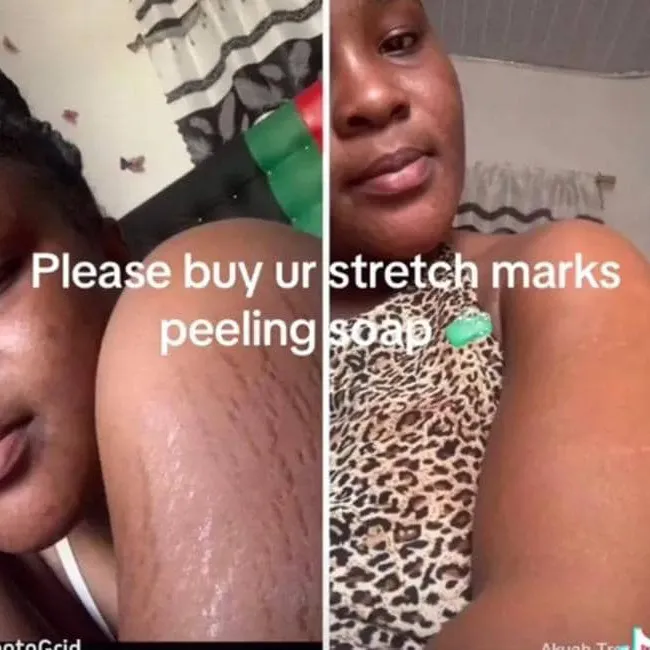 @preciouspeelingsoap