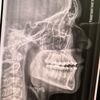 just.a.rat.maxilla