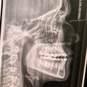 @just.a.rat.maxilla