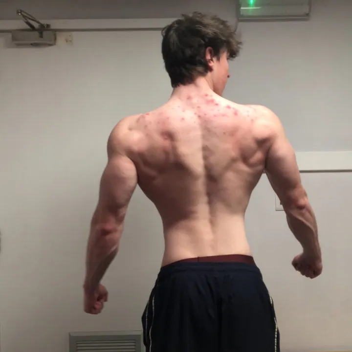 anterior.delt