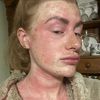 mybrokenskin