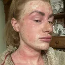 @mybrokenskin