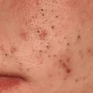 @belinda123542