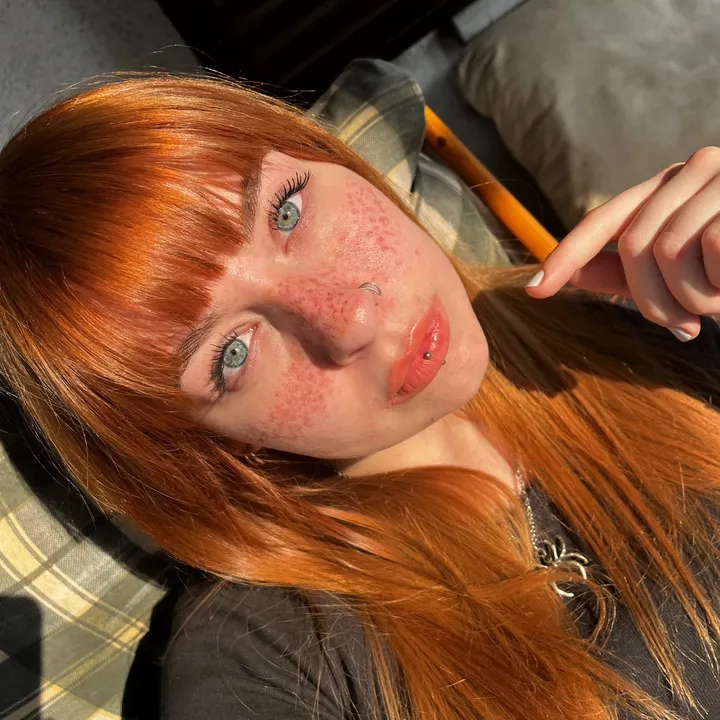 @encefalice