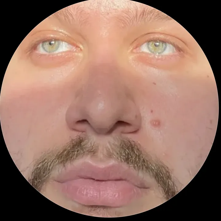 arinbicer