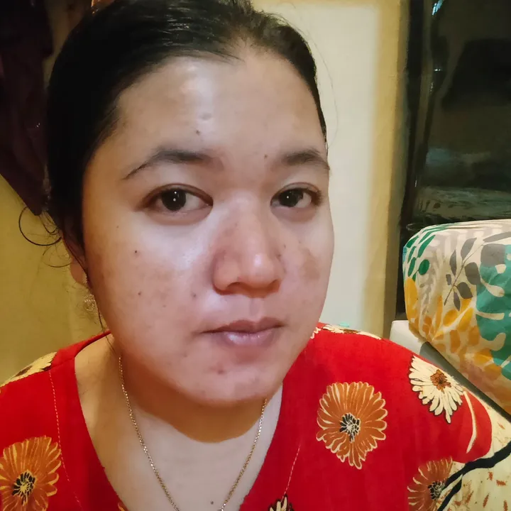 @ita_skinjourney