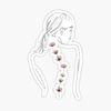twin_with.scoliosis