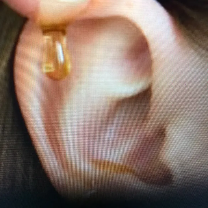 ear.cleaning61