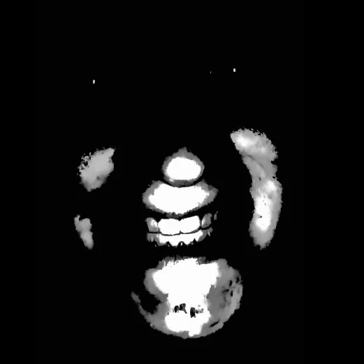 deadrat1987