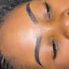 the_brow_surgeon
