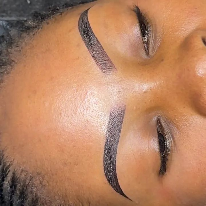 the_brow_surgeon