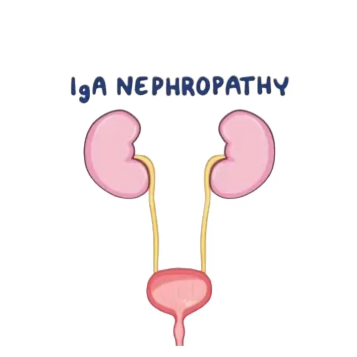 iganephropathyph