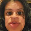 lachapinaadali