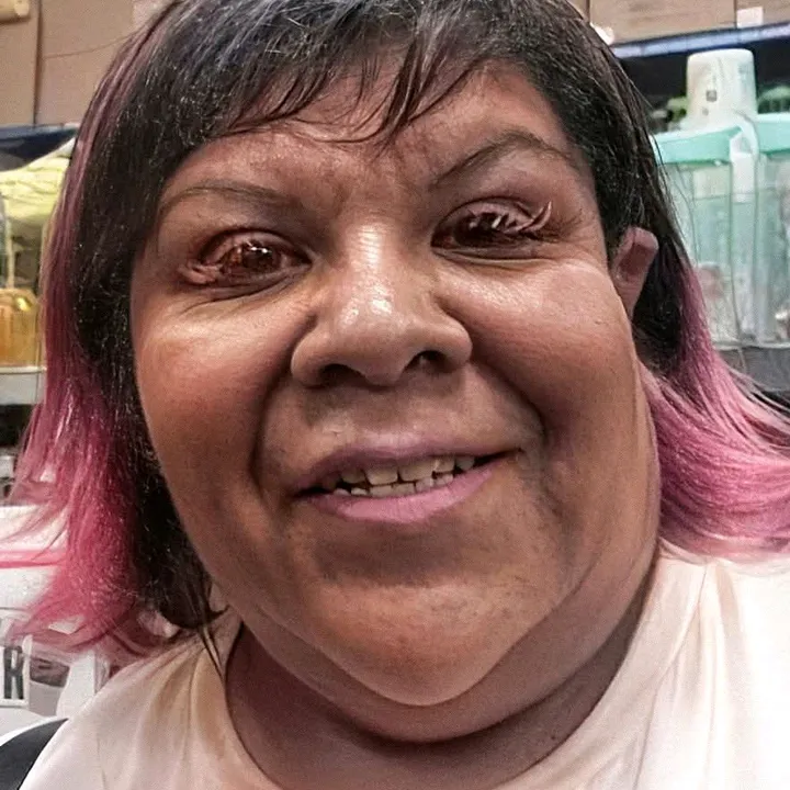 xemperax