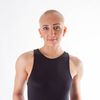 alopeciadiaries_