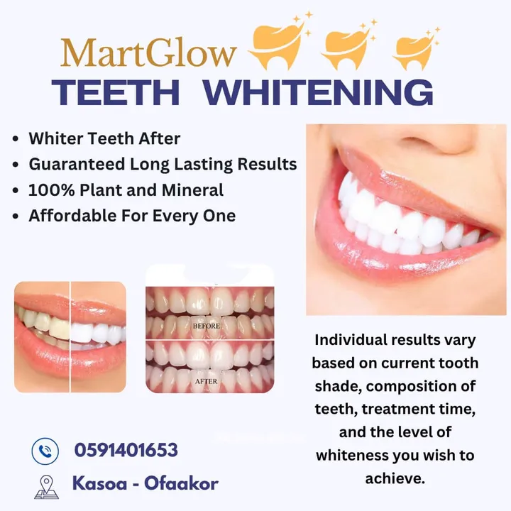 teethwhitening485