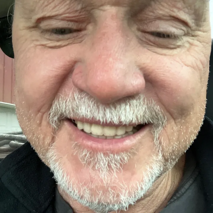 mike_overeze