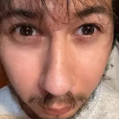 xxxkingblinkey