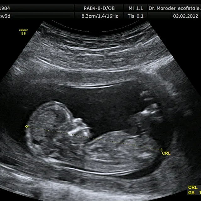 babyinside7