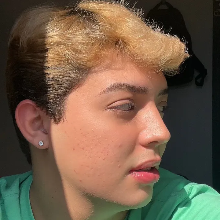 @matteozv