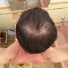 scalp.diary