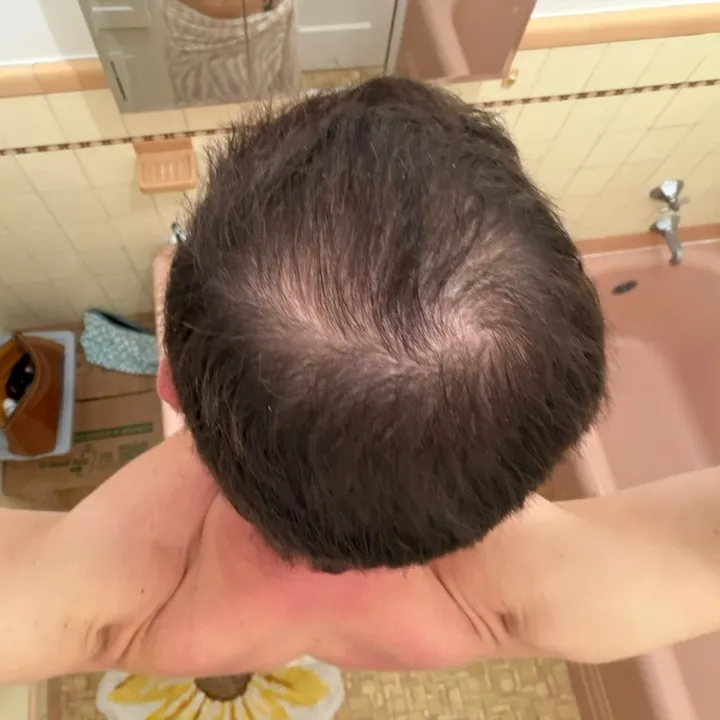 scalp.diary