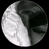 misschin087