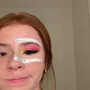 @harperpigmintation