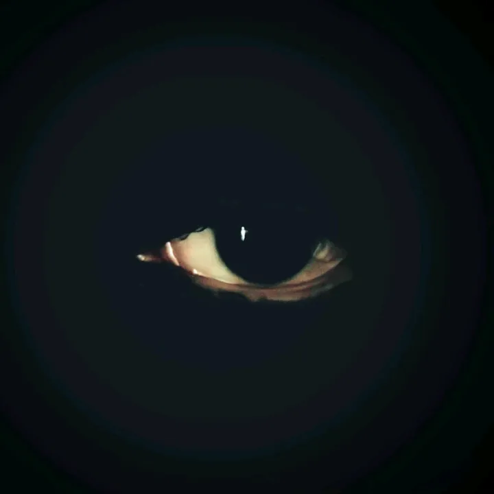 @aldorfreaband